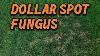 Dollar Spot Lawn Fongus A Détruit Ma Nouvelle Pelouse